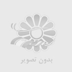 ایمپلنت دندان چقدر طول میکشد؟ پاسخ به این سوال مهم